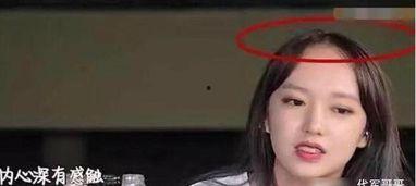 盘点脱发严重的女明星